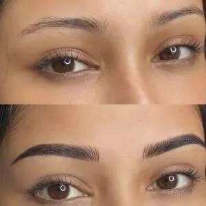 Combination-Brows-in-Mumbai-Before-And-After_-1