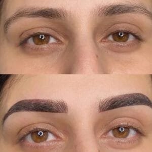 Combination-Brows-in-Mumbai-Before-And-After_-2