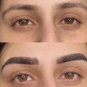 Combination-Brows-in-Mumbai-Before-And-After_-2