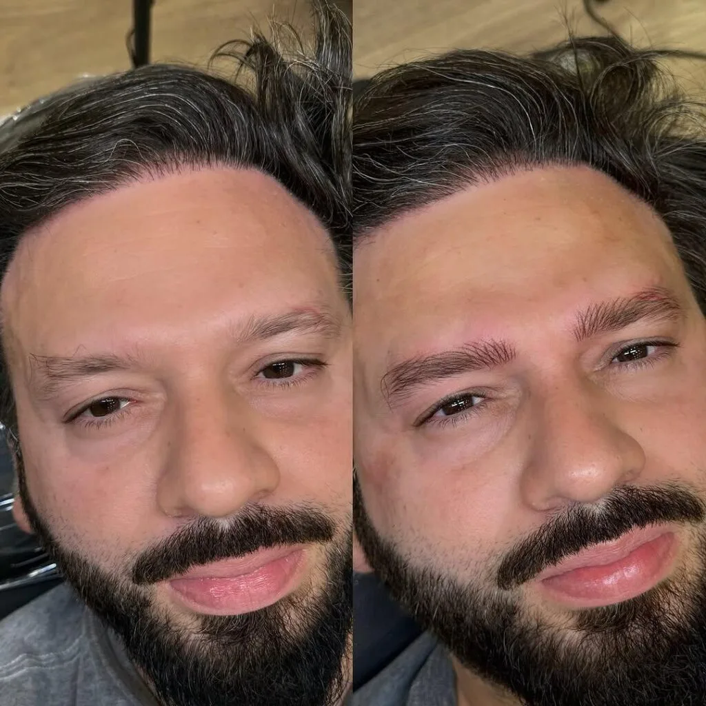 Nanoblading Eyebrows in Mumbai for Male