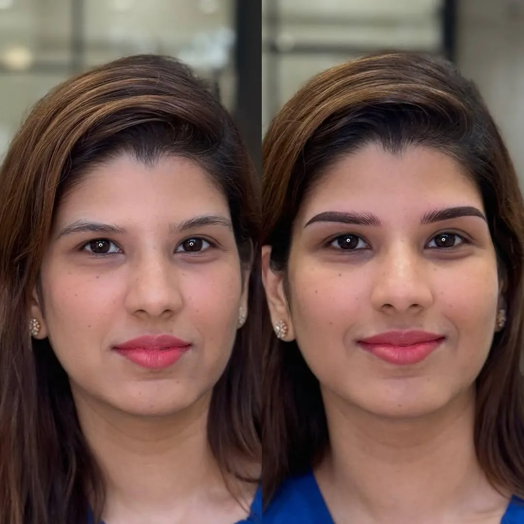 Nanoblading Eyebrows in Mumbai for female