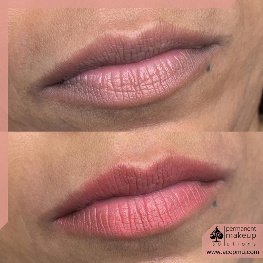 new img lip 29