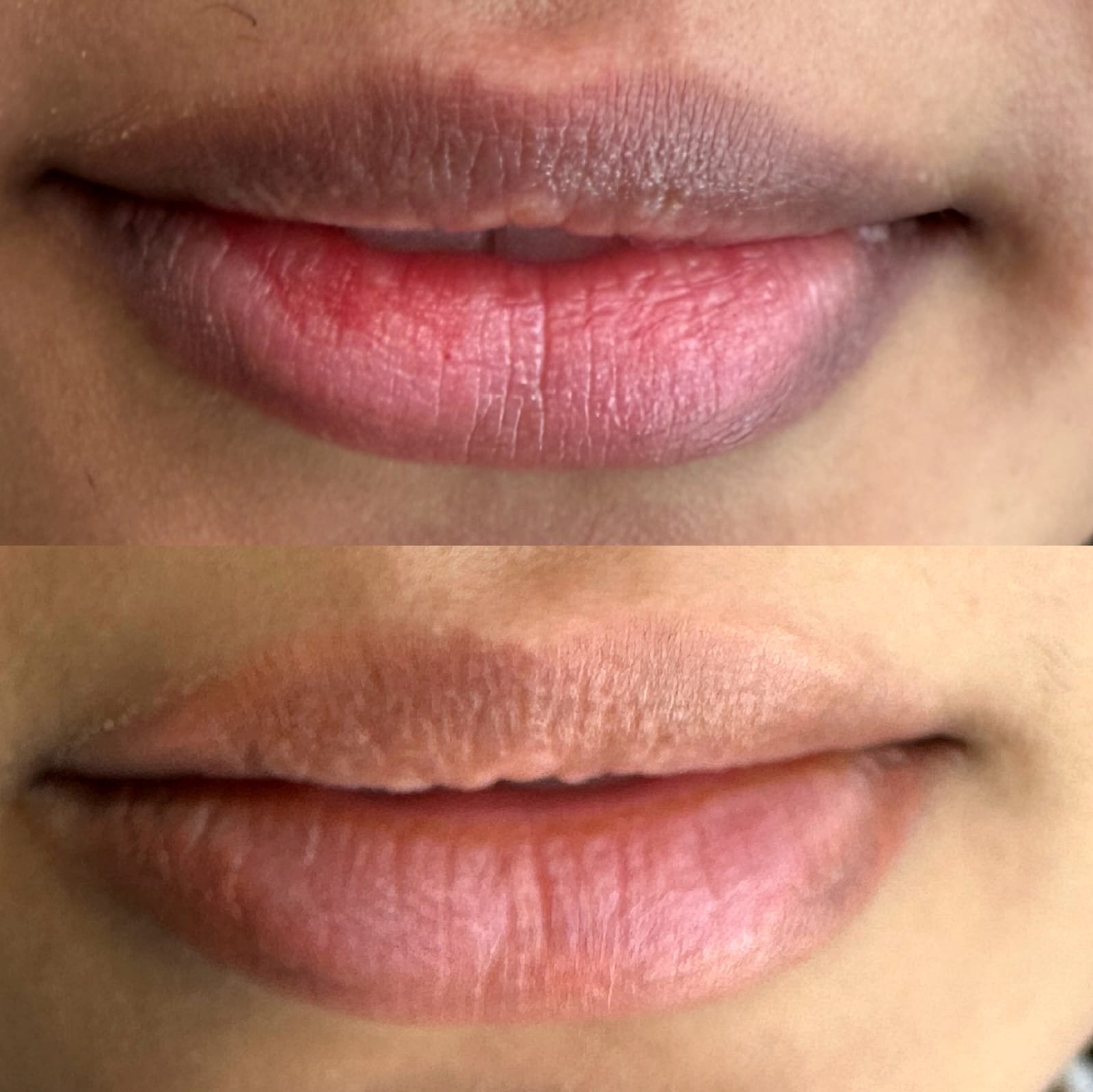 new img lip 32