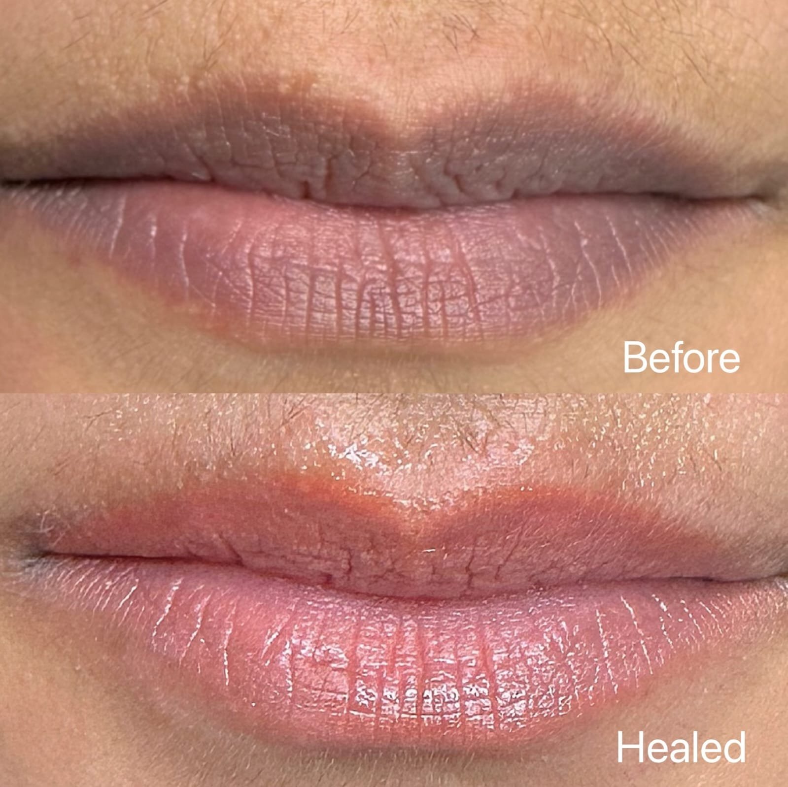 new img lip 33