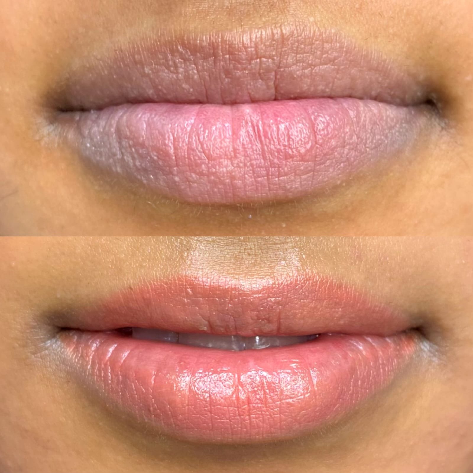 new img lip 34