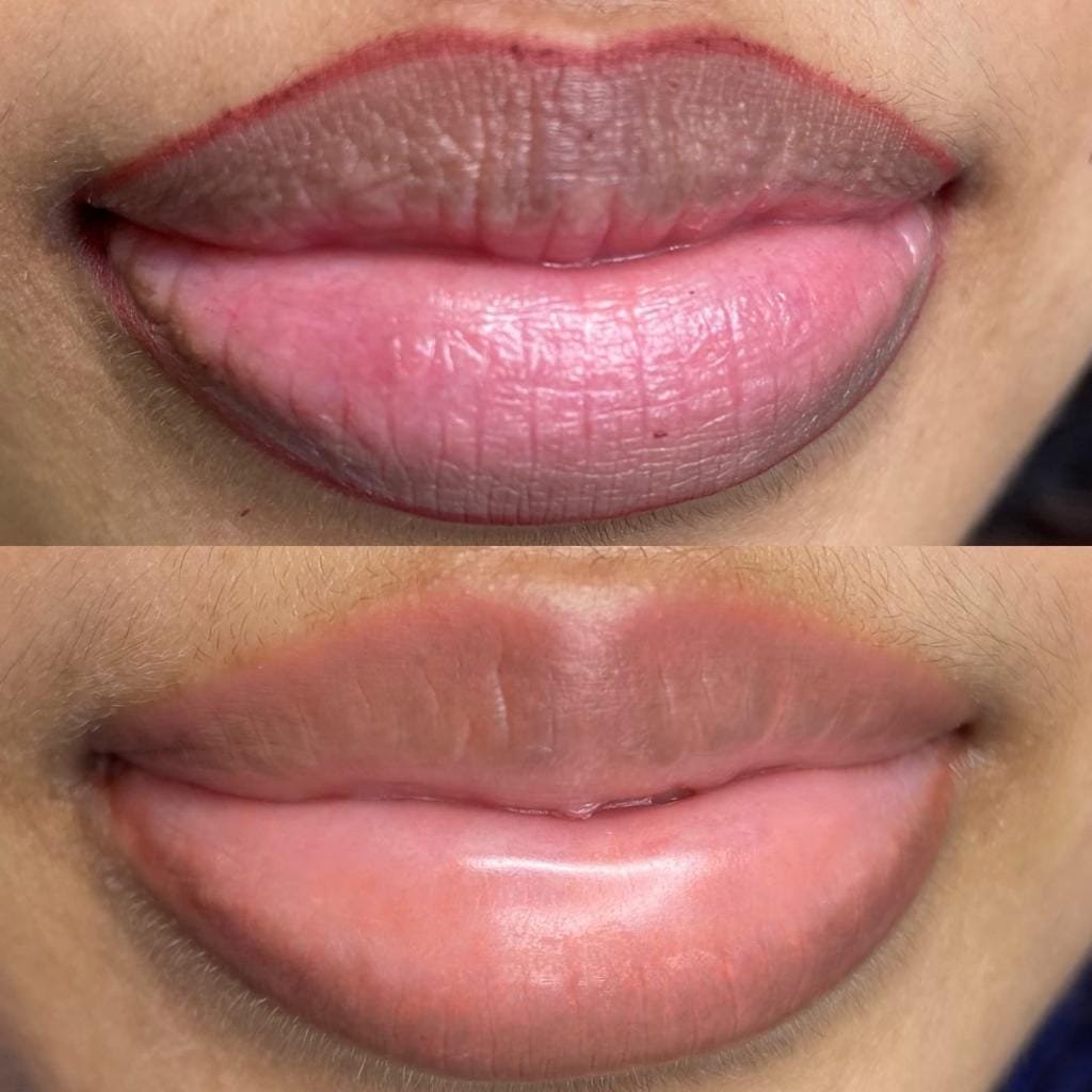 new img lip 36