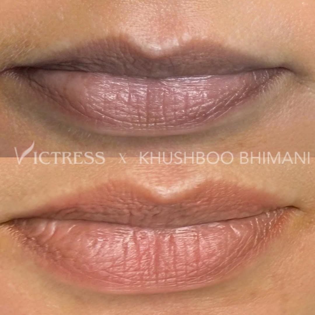 new img lip 38