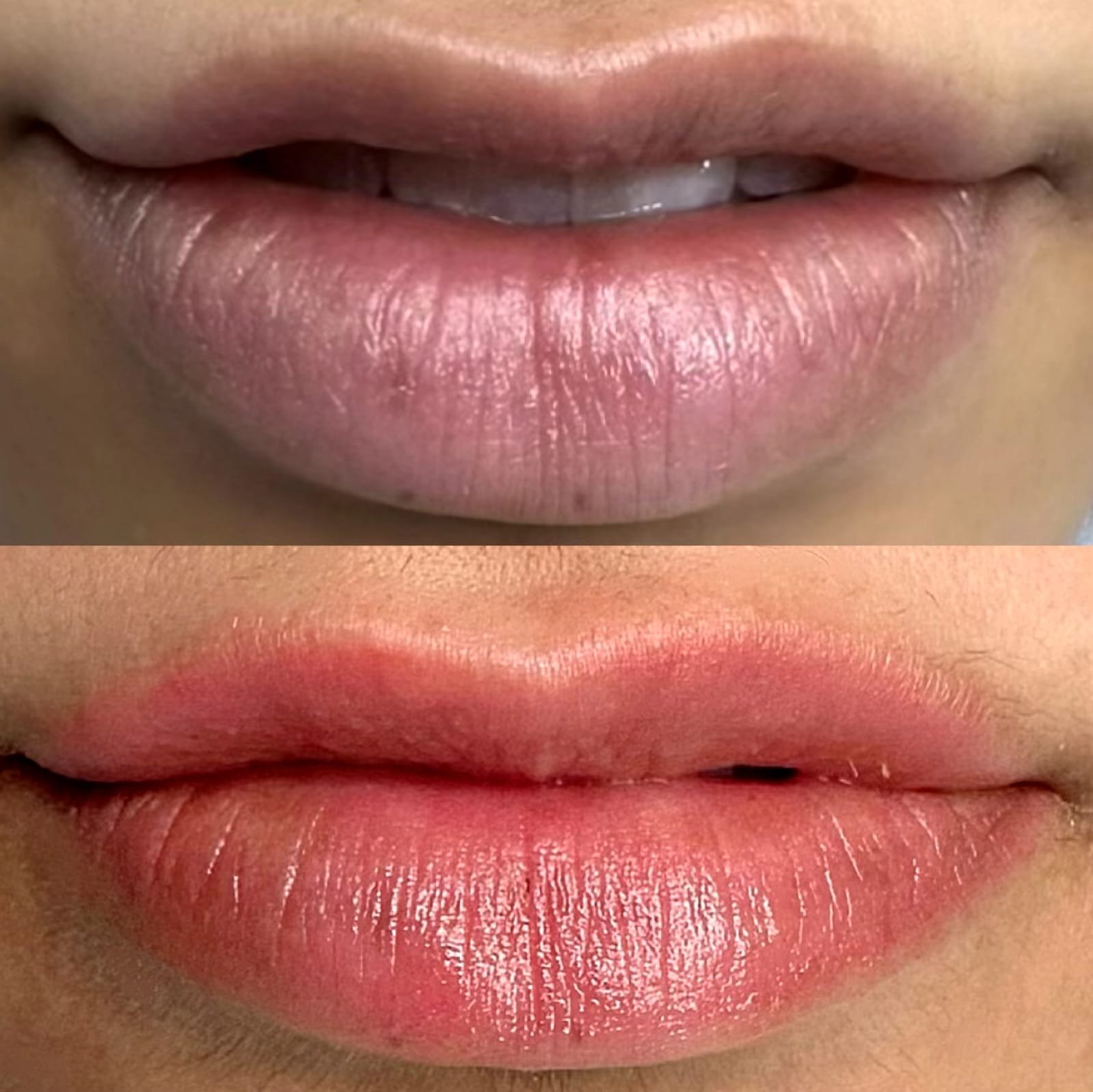 new img lip1
