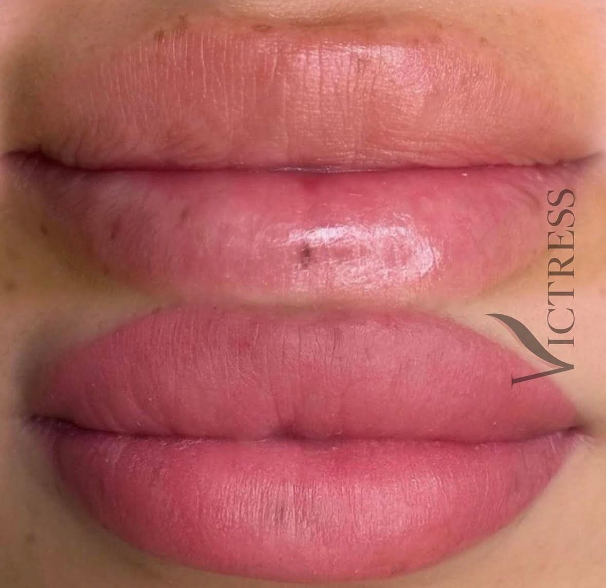 new img lip2